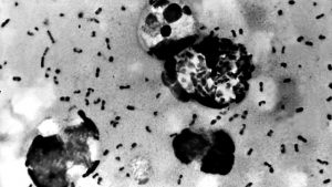 Bubonic plague found in Wyoming cat, 3rd such infection in 6 months
