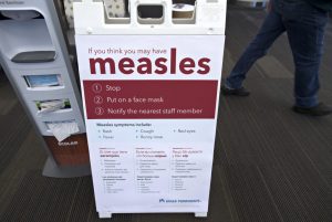 53 cases of measles confirmed in Washington state