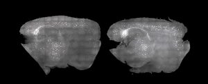 Scientists ‘Clear’ Alzheimer’s Plaque From Mice Using Only Light And Sound