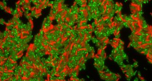How bacteria nearly killed by antibiotics can recover — and gain resistance