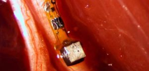 Scientists Getting Closer to “Smart Dust” Brain Implants with Links to Wi-Fi