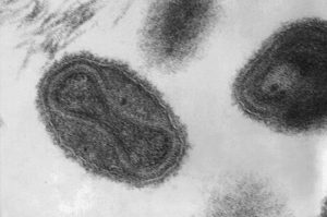 An explosion rocked a Russian research facility known for housing the smallpox virus