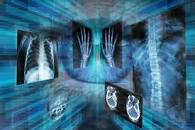 Millions of Americans’ medical images and data left ‘unprotected’ online, investigation reveals