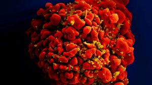 ‘This is an outlier’: New strain of HIV detected for 1st time in almost 20 years