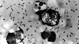 Two people diagnosed with pneumonic plague in China