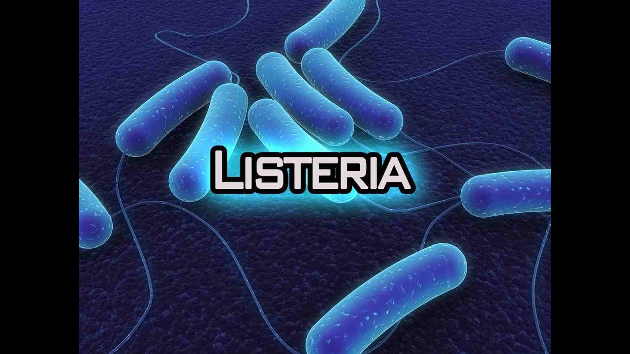 3 dead after drinking milkshakes made in Listeria-contaminated machine…