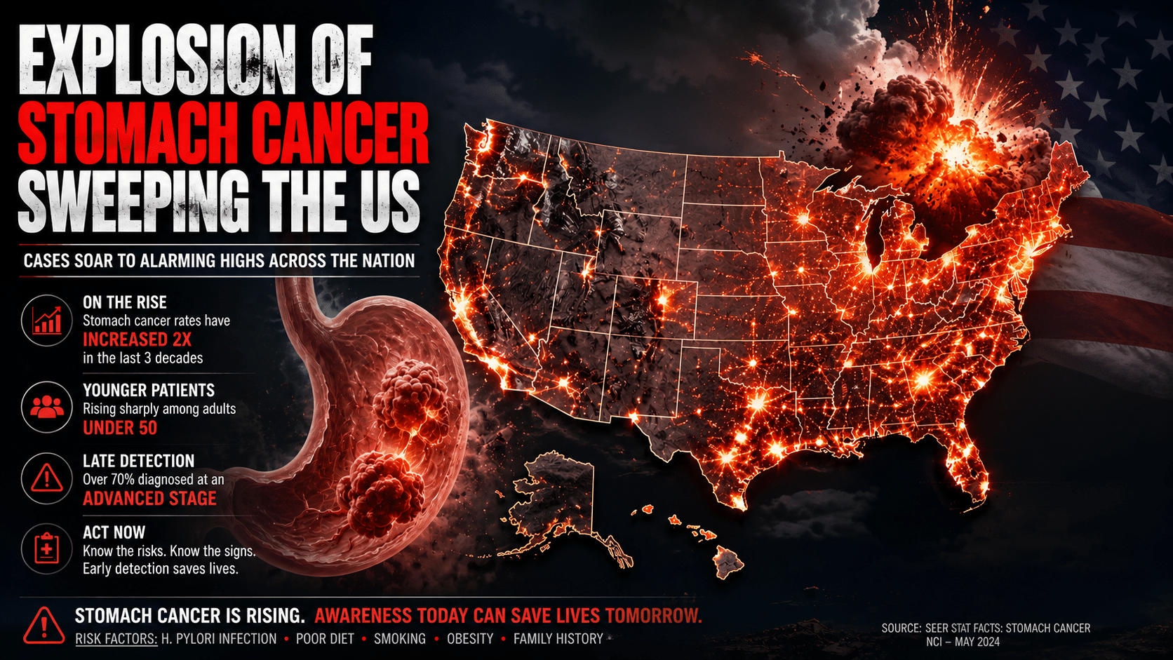 Explosion of stomach cancer sweeping the US