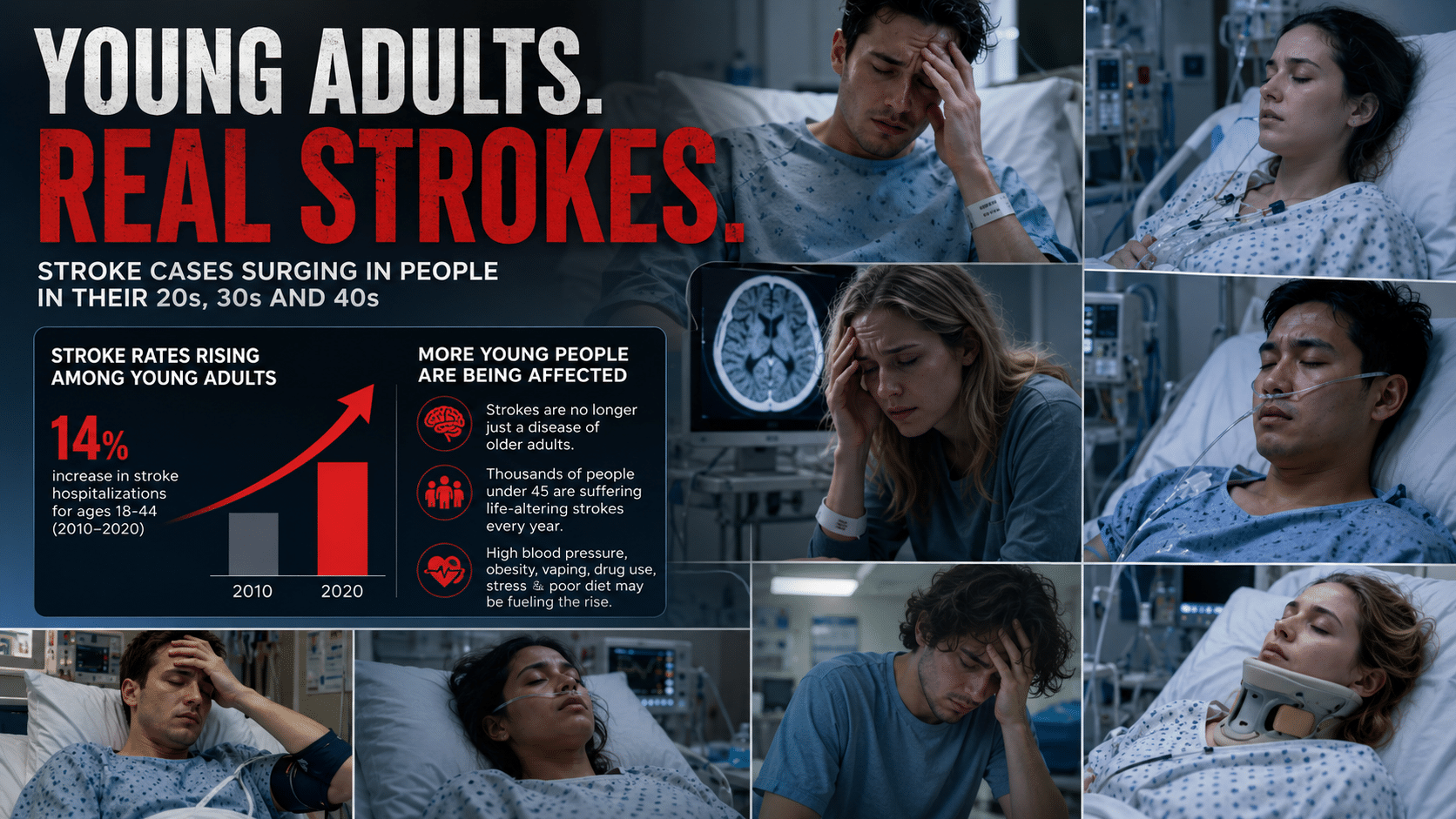 Growing number of people are having strokes in their 20s, 30s and 40s, ‘We’ve never had patients so young’